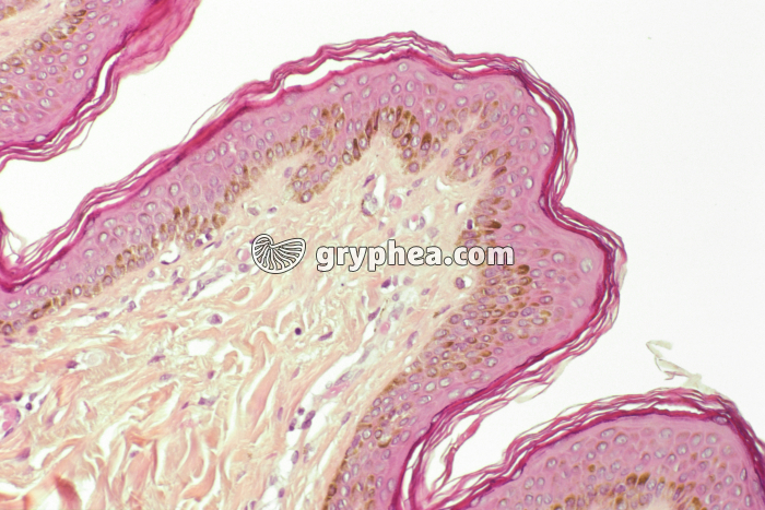 Peau race noire CT x70 - gryphea.org